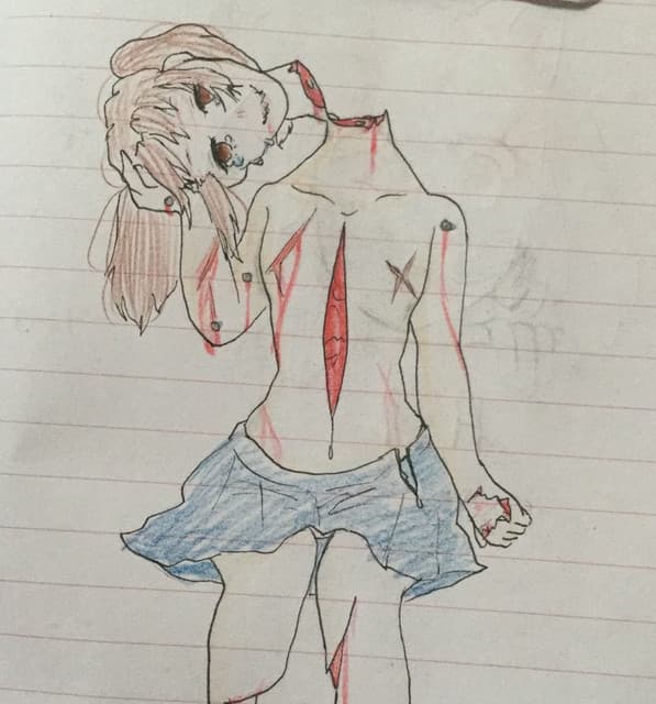 Hysteria