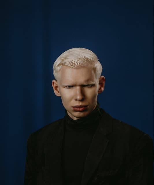 ALBINO